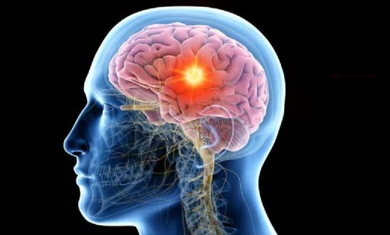 ¿En cuánto tiempo se recupera el cerebro del consumo excesivo de alcohol?