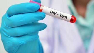 Pruebas rápidas de VIH son clave en la prevención y tratamiento oportuno