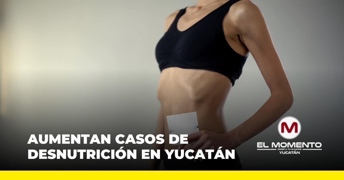 Yucatán reporta un incremento del 22.8% en casos de desnutrición en comparación con 2024