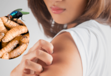 Confirman tercer caso de miasis por gusano barrenador en humanos en Chiapas