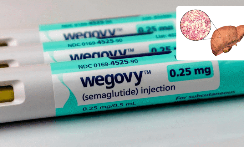 FDA aprueba medicamento contra la obesidad para tratar enfermedad hepática grave en EE.UU.