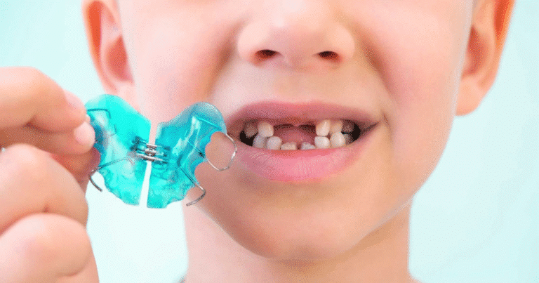 ¿tu hijo necesita ortodoncia señales clave que debes detectar desde los 6 años