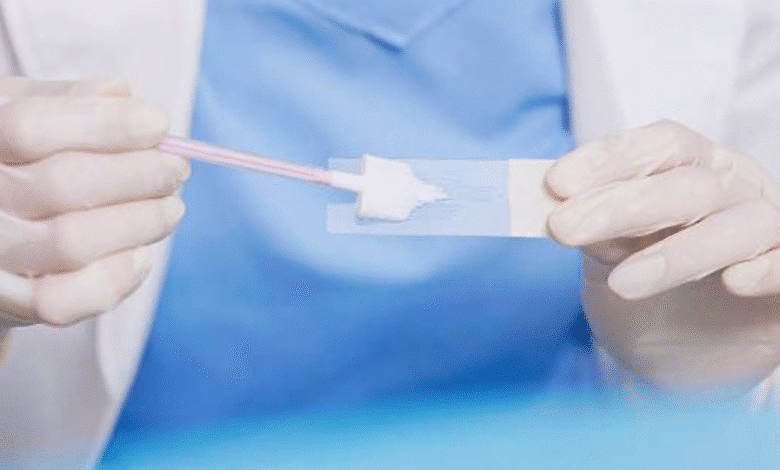 el dif municipal de mérida ofrecerá este estudios gratuitos de papanicolau y colposcopía