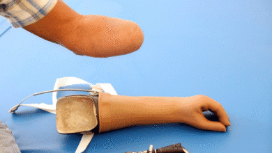 cropafy mejora la movilidad de yucatecos con entrega de prótesis y órtesis