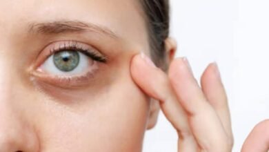 Dile adiós a las ojeras: remedios para dormir sin complicaciones (Foto de internet)