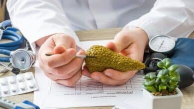 Cáncer de páncreas se dispara 85% en Yucatán en un año: alertan por diagnóstico tardío