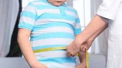 prevalece problema de obesidad en yucatán