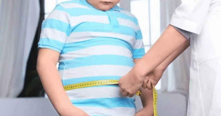 prevalece problema de obesidad en yucatán