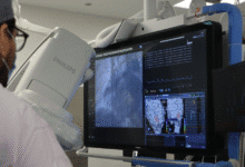 hraepy incorpora mapeo electroanatómico y logra hasta 90% de éxito en tratamiento de arritmias