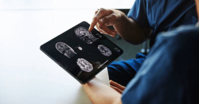 aumentan casos de enfermedades cerebrovasculares en yucatán durante 2026