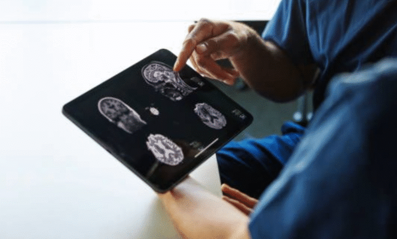 aumentan casos de enfermedades cerebrovasculares en yucatán durante 2026