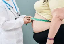 Aumentan diagnósticos de obesidad en Yucatán al inicio de 2026 (Foto de internet)