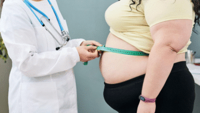 Aumentan diagnósticos de obesidad en Yucatán al inicio de 2026 (Foto de internet)