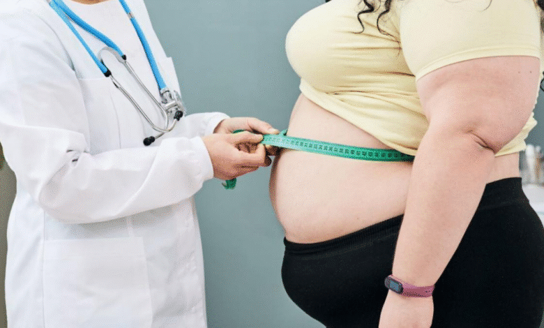 Aumentan diagnósticos de obesidad en Yucatán al inicio de 2026 (Foto de internet)