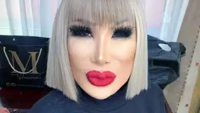 lyn may revela cómo vivió el cambio en su rostro