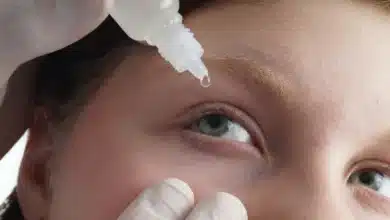 conjuntivitis no da tregua en yucatán se registran dos contagios por hora