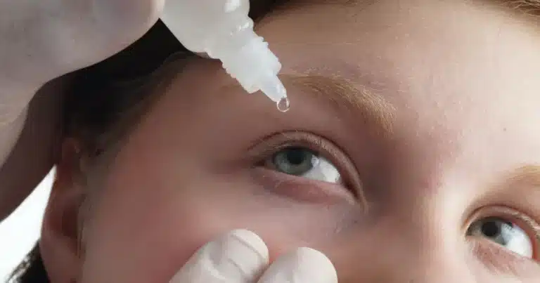 conjuntivitis no da tregua en yucatán se registran dos contagios por hora
