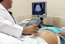 ¿embarazada y asegurada estos son los requisitos para obtener la incapacidad por maternidad