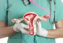 Yucatán reporta 36 casos de cáncer de útero en 2026 (Imagen de internet)