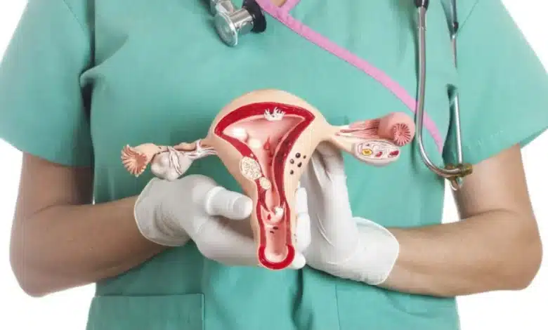 Yucatán reporta 36 casos de cáncer de útero en 2026 (Imagen de internet)