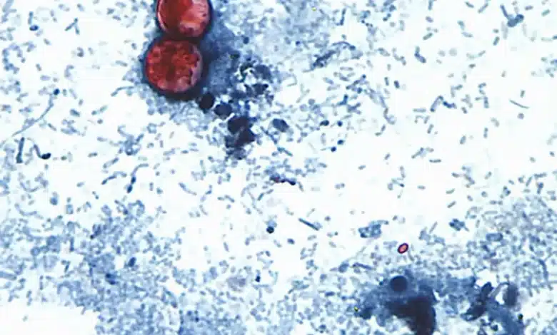 estados unidos confirma dos muertes por brote de ciclosporiasis asociado al parásito cyclospora