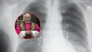 qué es el adenocarcinoma pulmonar, el tumor detectado al papa león xiv